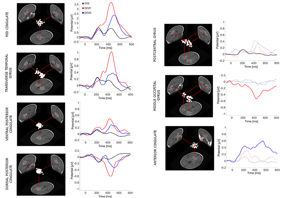  Estimated cortical locations of independent component (IC) clusters of effective sources across subjects that contribute the most to the scalp grand-mean ERP