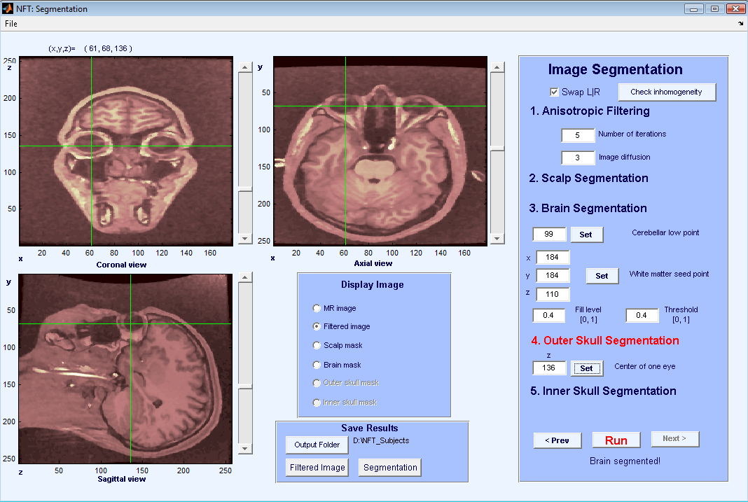 Figure 6: Interface of segmentation to select an axial slice where the eyes are clearly observed.