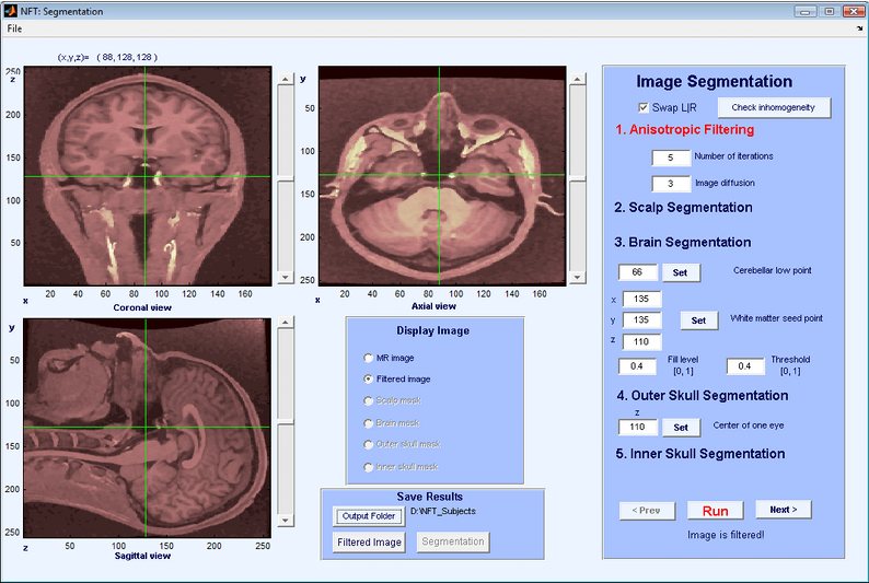 Figure 3: Interface for segmentation