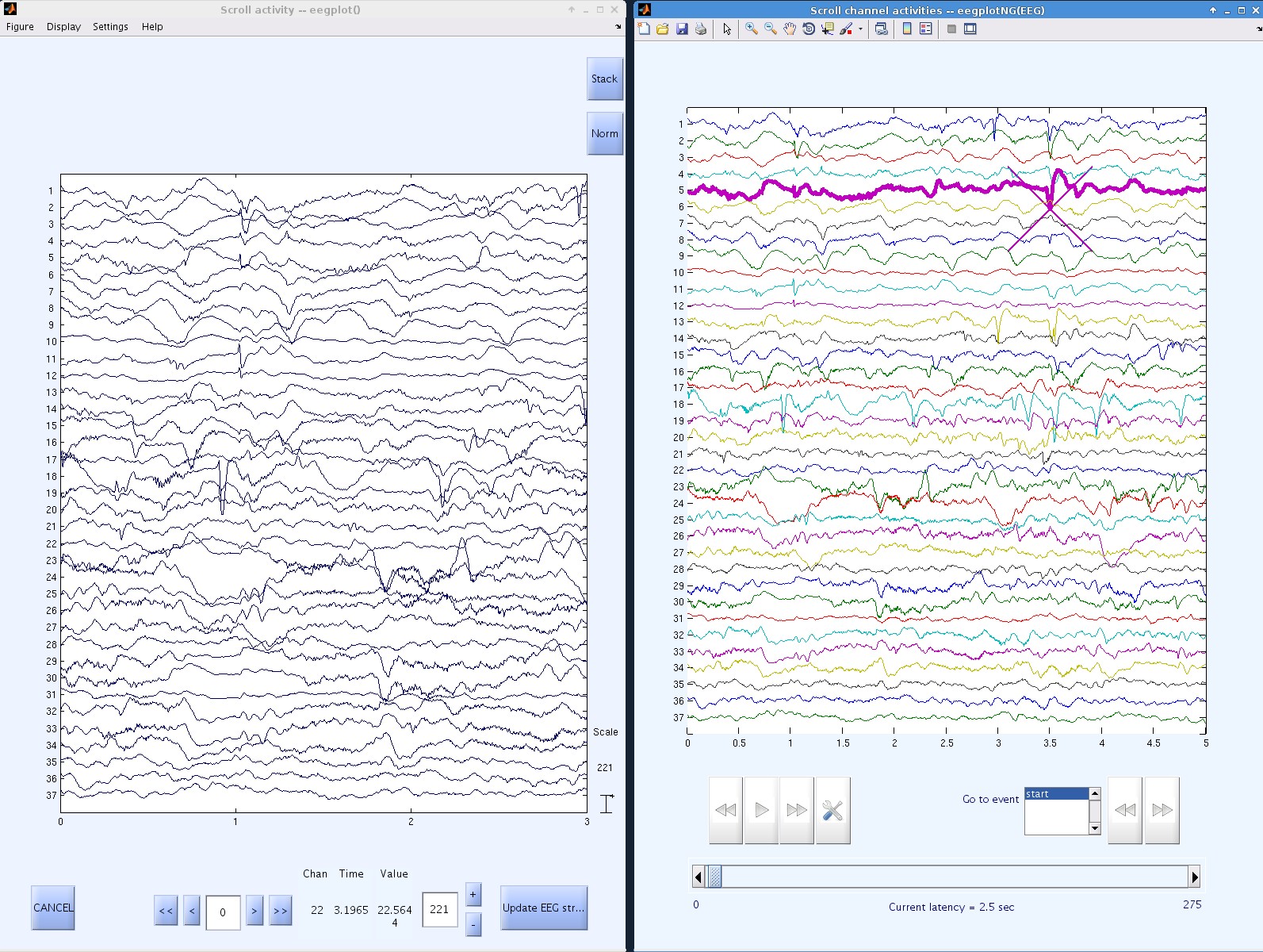 thumb|400px|Figure 4. Manually marking HFOs. Left, using VisEd. Right, using customized MoBILAB plots.