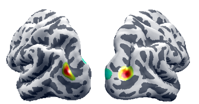 EEG source imaging on cortex